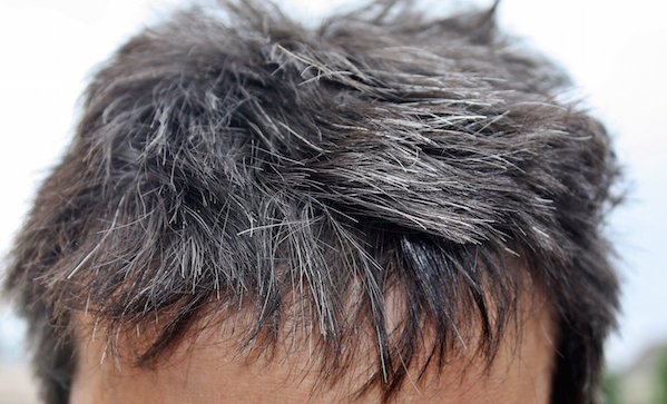 Stress May Really Turn Your Hair Grey | PURSUIT